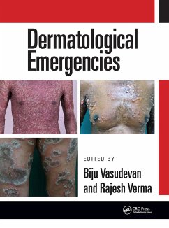 Dermatological Emergencies