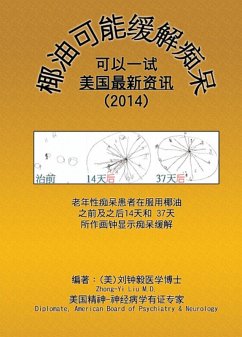 Coconut Oil May Ameliorate Dementia (eBook, ePUB) - Liu, Zhong-Yi; ¿¿