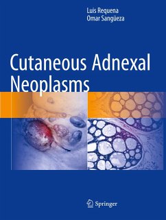 Cutaneous Adnexal Neoplasms - Requena, Luis;Sangüeza, Omar