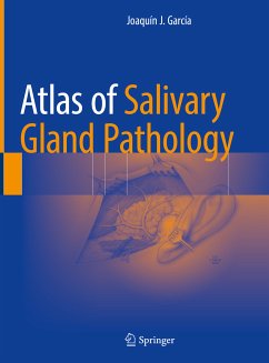 Atlas of Salivary Gland Pathology (eBook, PDF) - García, Joaquín J.