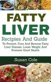 Fatty Liver (eBook, ePUB)