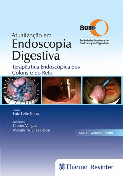 Atualização em Endoscopia Digestiva (eBook, ePUB) - Luna, Luiz Leite