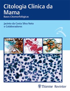 Citologia Clínica da Mama (eBook, ePUB) - Neto, Jacinto da Costa Silva