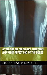 A Treatise on Fractures, Luxations, and other Affections of the Bones (eBook, PDF) - Desault, Joseph; Pierre