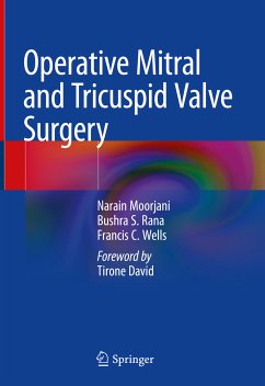 Operative Mitral and Tricuspid Valve Surgery (eBook, PDF) - Moorjani, Narain; Rana, Bushra S.; Wells, Francis C.