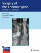 Surgery of the Thoracic Spine - Bild 1