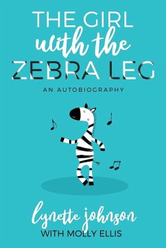 The Girl with the Zebra Leg - Johnson, Lynette