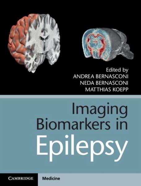 Imaging Biomarkers in Epilepsy (eBook, ePUB) Imaging Biomarkers in Epilepsy (eBook, ePUB)