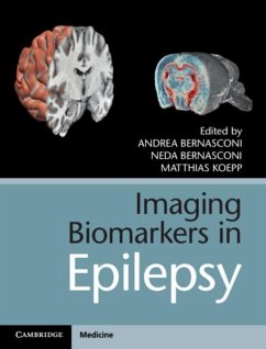 Cover Imaging Biomarkers in Epilepsy (eBook, PDF)