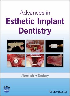 Advances in Esthetic Implant Dentistry (eBook, ePUB) - Elaskary, Abdelsalam