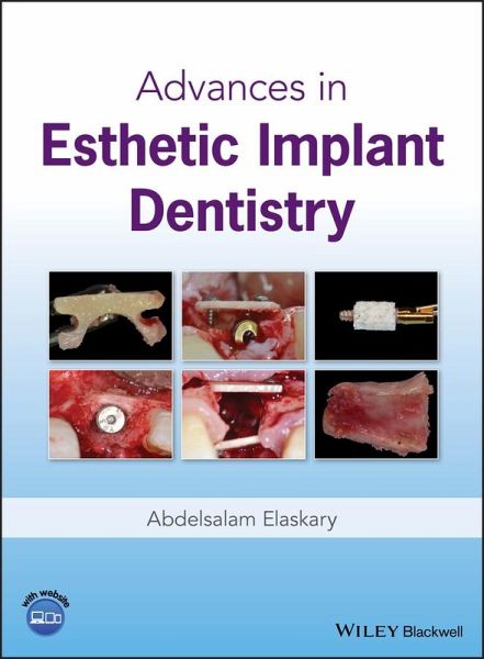 Advances in Esthetic Implant Dentistry (eBook, ePUB)