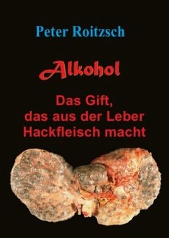 Alkohol - Das Gift, das aus der Leber Hackfleisch macht - Roitzsch, Peter