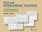 ECG and Intracardiac Tracings