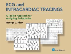 Cover ECG and Intracardiac Tracings