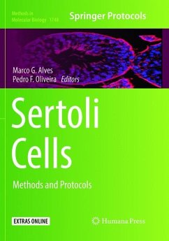 Sertoli Cells