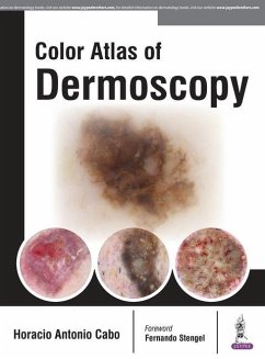 Color Atlas of Dermoscopy - Cabo, Horacio