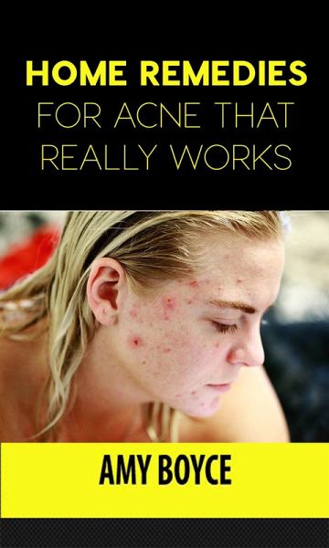 Home Remedies for Acne That Really Works (eBook, ePUB) Home Remedies for Acne That Really Works (eBook, ePUB)