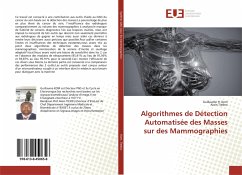 Algorithmes de Détection Automatisée des Masses sur des Mammographies - Kom, Guillaume H.;Tiedeu, Alain