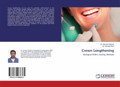 Crown Lengthening - Khajuria, Sameer;Kour, Ravneet