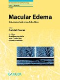 Macular Edema (eBook, ePUB)