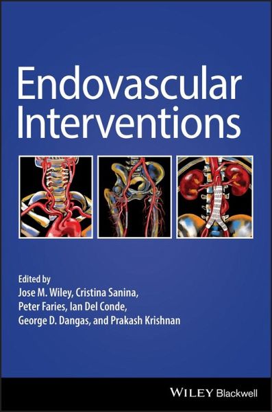 Endovascular Interventions (eBook, PDF)