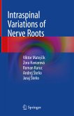 Intraspinal Variations of Nerve Roots (eBook, PDF)