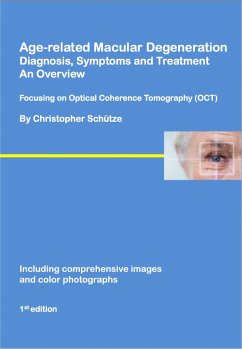 Age-related macular degeneration (eBook, ePUB) - Schütze, Christopher