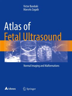 Atlas of Fetal Ultrasound - Bunduki, Victor;Zugaib, Marcelo