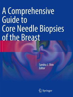 A Comprehensive Guide to Core Needle Biopsies of the Breast