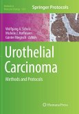 Urothelial Carcinoma Urothelial Carcinoma