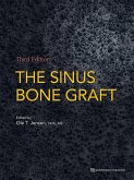The Sinus Bone Graft (eBook, ePUB)