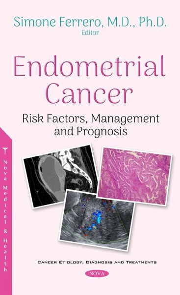Endometrial Cancer: Risk Factors, Management and Prognosis (eBook, PDF)
