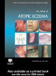 An Atlas of Atopic Eczema (eBook, PDF) - Bild 1