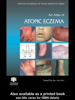 An Atlas of Atopic Eczema (eBook, PDF) - Fry, Lionel