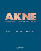 Acne (eBook, PDF)