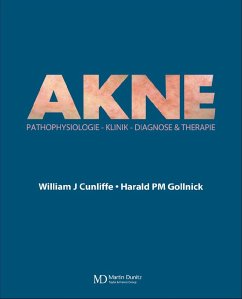 Acne (eBook, PDF) - Cunliffe, William J; Gollnick, Harald Pm