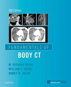 Fundamentals of Body CT E-Book (eBook, ePUB) - Webb, W. Richard; Brant, Wiliam E.; Major, Nancy M.