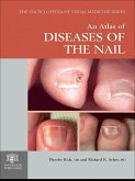 An Atlas of Diseases of the Nail (eBook, PDF)