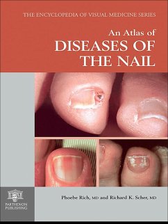 An Atlas of Diseases of the Nail (eBook, PDF) - Rich, Phoebe; Scher, Richard K.