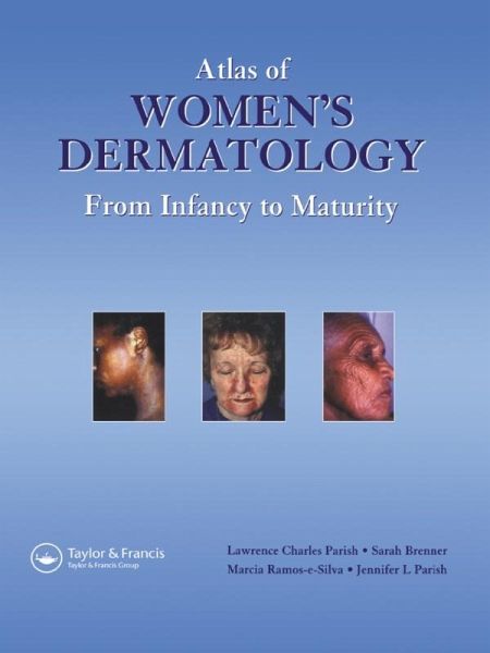 Atlas of Women's Dermatology (eBook, PDF) Atlas of Women's Dermatology (eBook, PDF)