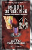 Angiography and Plaque Imaging (eBook, ePUB)
