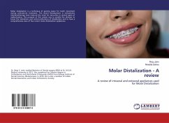 Molar Distalization - A review - John, Rinju;Sahoo, Nivedita