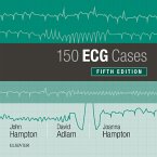 150 ECG Cases (eBook, ePUB)