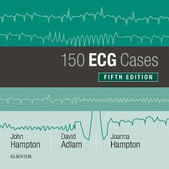 150 ECG Cases (eBook, ePUB) - Hampton, John; Adlam, David; Hampton, Joanna