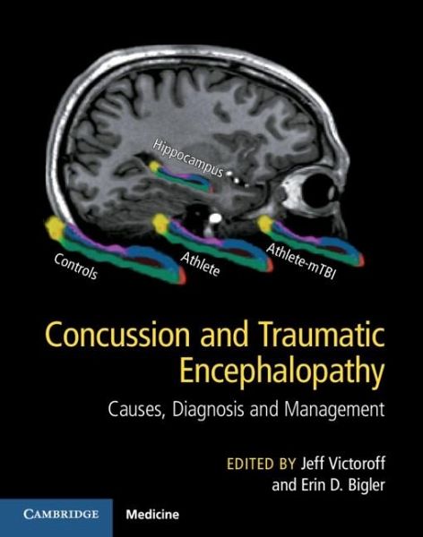 Concussion and Traumatic Encephalopathy (eBook, ePUB) Concussion and Traumatic Encephalopathy (eBook, ePUB)