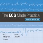 The ECG Made Practical (eBook, ePUB)