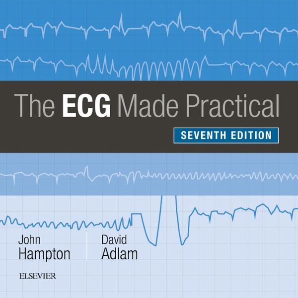 The ECG Made Practical (eBook, ePUB)