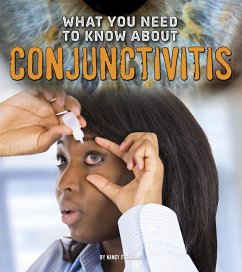 Cover What You Need to Know about Conjunctivitis (eBook, PDF)