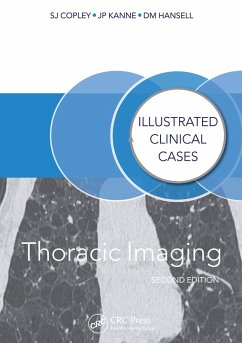 Cover Thoracic Imaging (eBook, PDF)