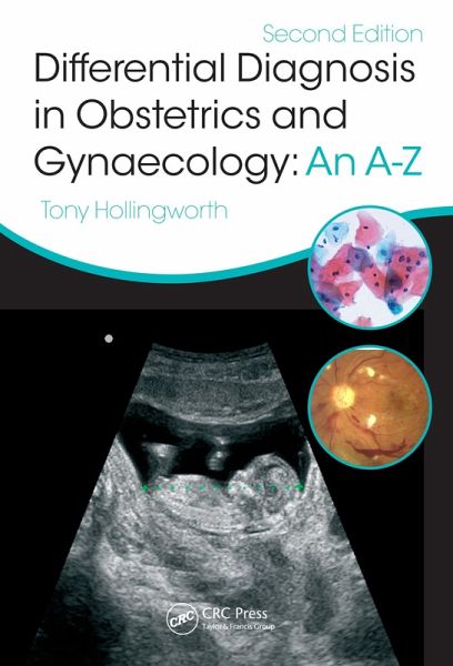 Differential Diagnosis in Obstetrics & Gynaecology (eBook, ePUB)
